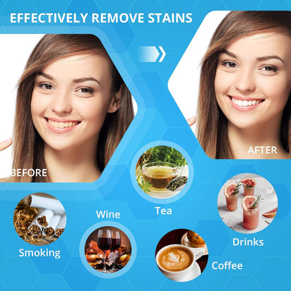 Kit Blanqueador Premium para Sonrisas Radiantes™